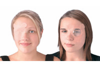Niko eye-fix oogpleister nonwoven gevleugelde vorm huidskleur ref 640
